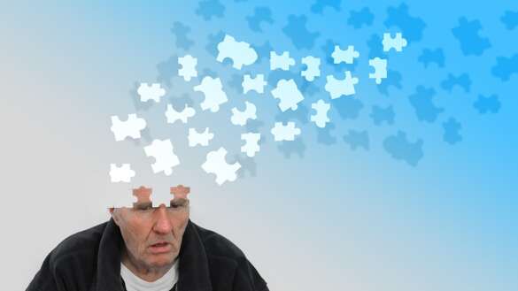 Älterer Mann mit fehlenden Puzzleteilen am Kopf, Symbolbild Demenz